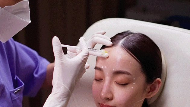 Filler injection